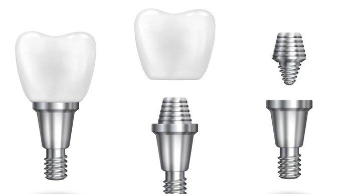 Illustration: zirconia dental crowns